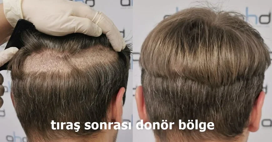 saç kesmeden ekim