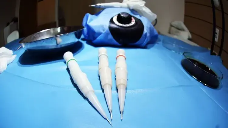 Se utilizan diferentes agujas en el método de pluma de implante.