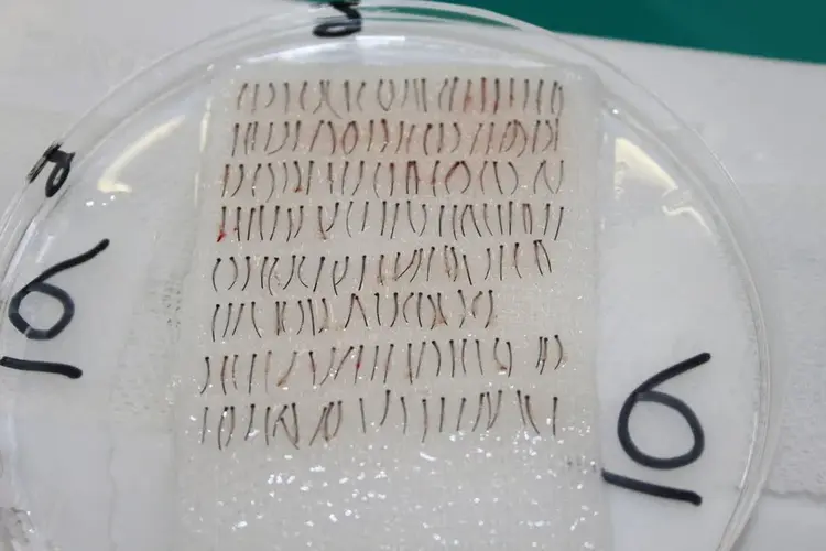 фолликулы из бороды